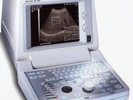    Logiq 100 Pro   GE Ultrasound - Logiq 100 Pro -     . 
 Logiq 100 Pro -,  -  