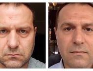 :   , Instantly Ageless        ,      